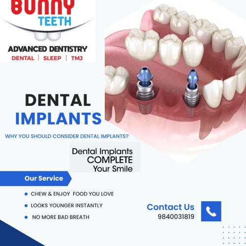 Discover the Life-Changing Benefits of Dental Implants: A Permanent Solution for Your Missing Teeth.