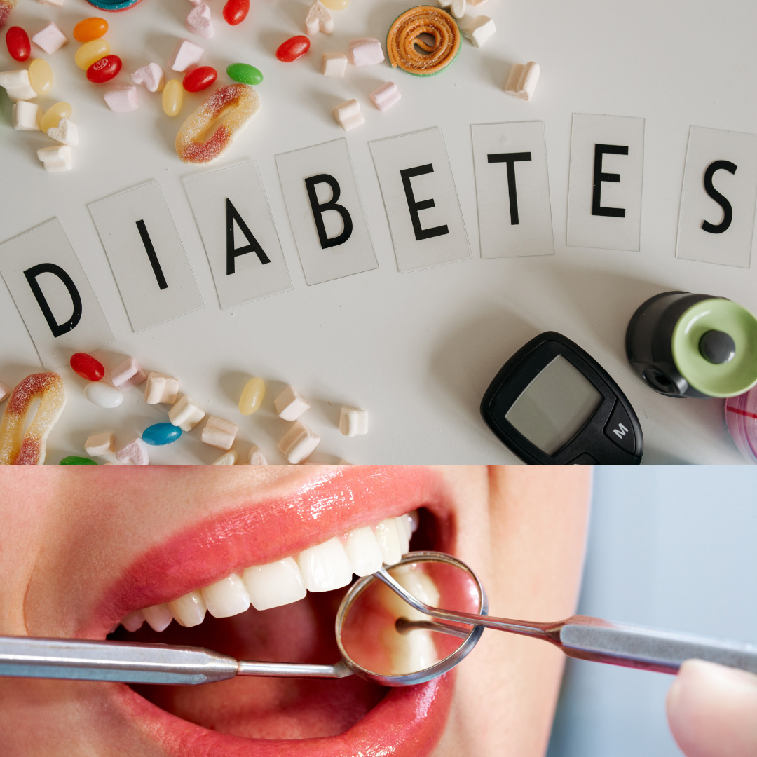  How is diabetes related to dental health?