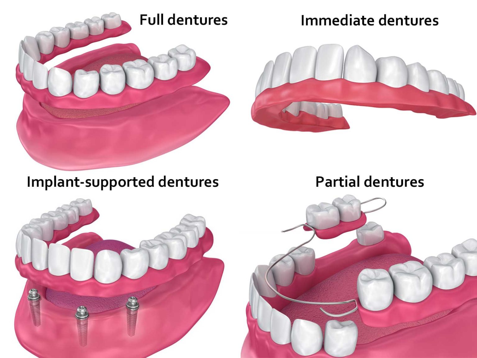 What are dentures, and how to clean them properly